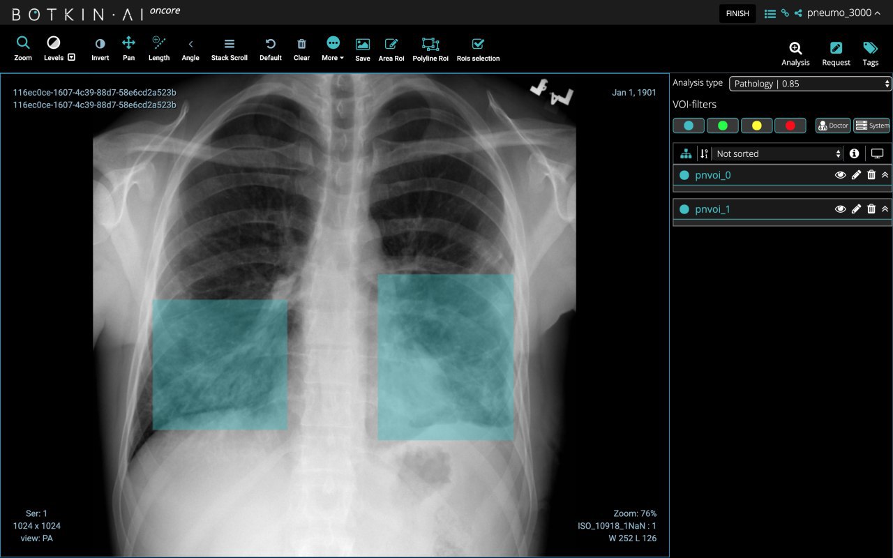 러시아 AI 의료 영상 분석·진단 스타트업